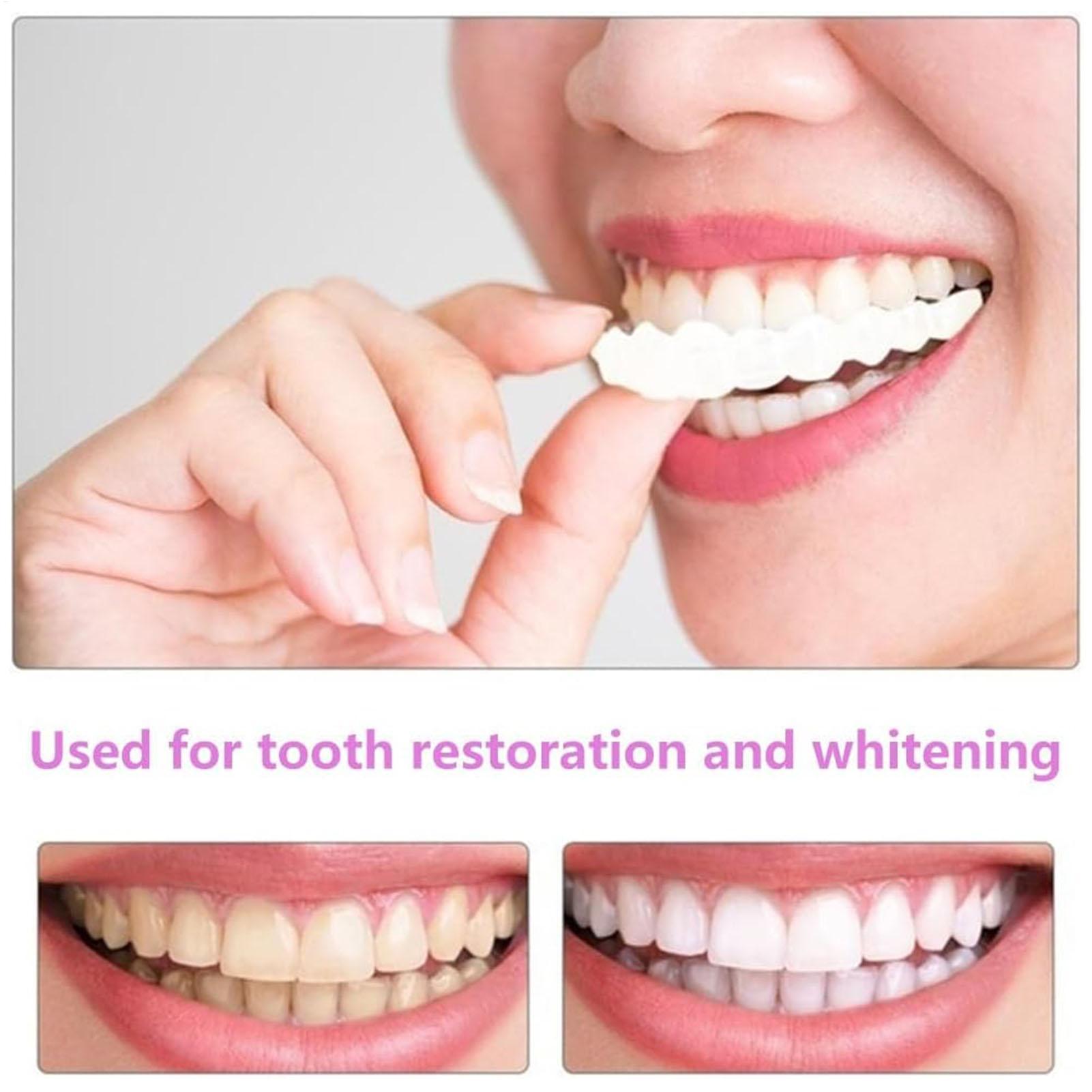 Teeth Whitening Fast - 1쌍 장기용 치아 미백 가짜 치아