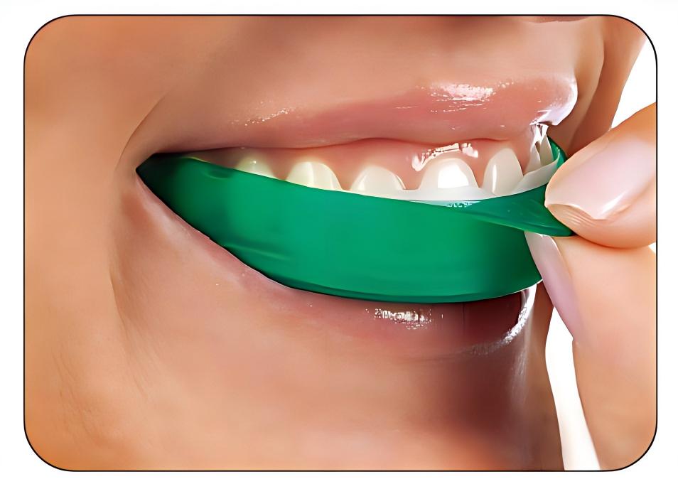 Teeth Whitening Opalescence Go - 울트라덴트 오팔레센스 고 치아 미백 스트립