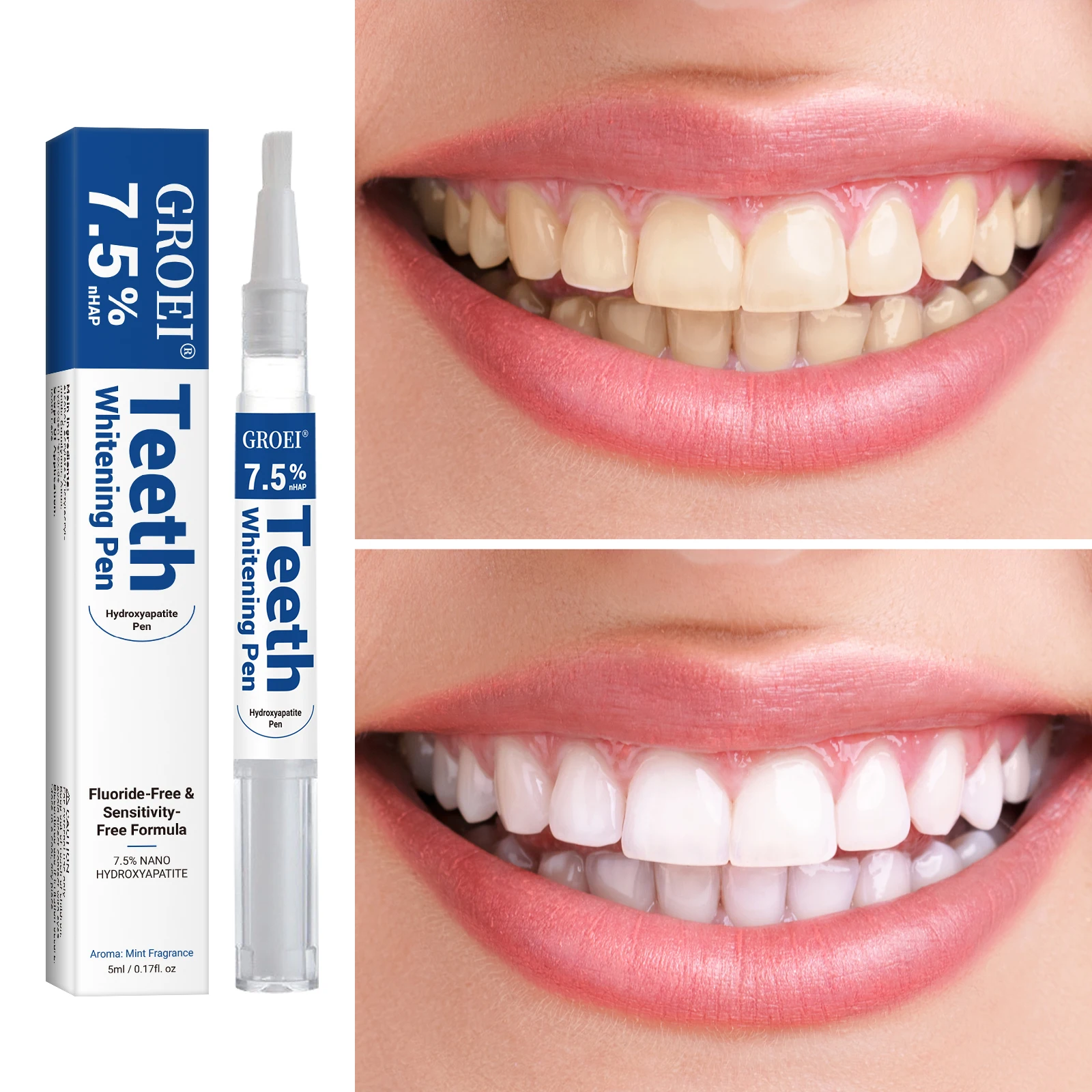하이드록시아파타이트 치아 미백 펜 눈부신 화이트 얼룩  - Teeth Whitening Doctor 리뷰 및 가격