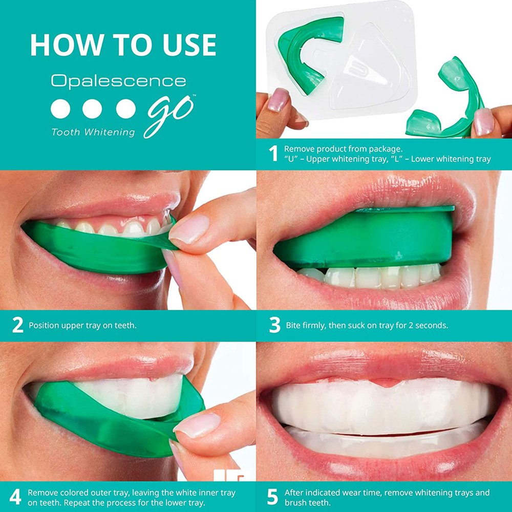 치아 미백용 과산화 수소, 유백광 고 프리필 트레이,  - Teeth Whitening With Trays 리뷰 및 가격