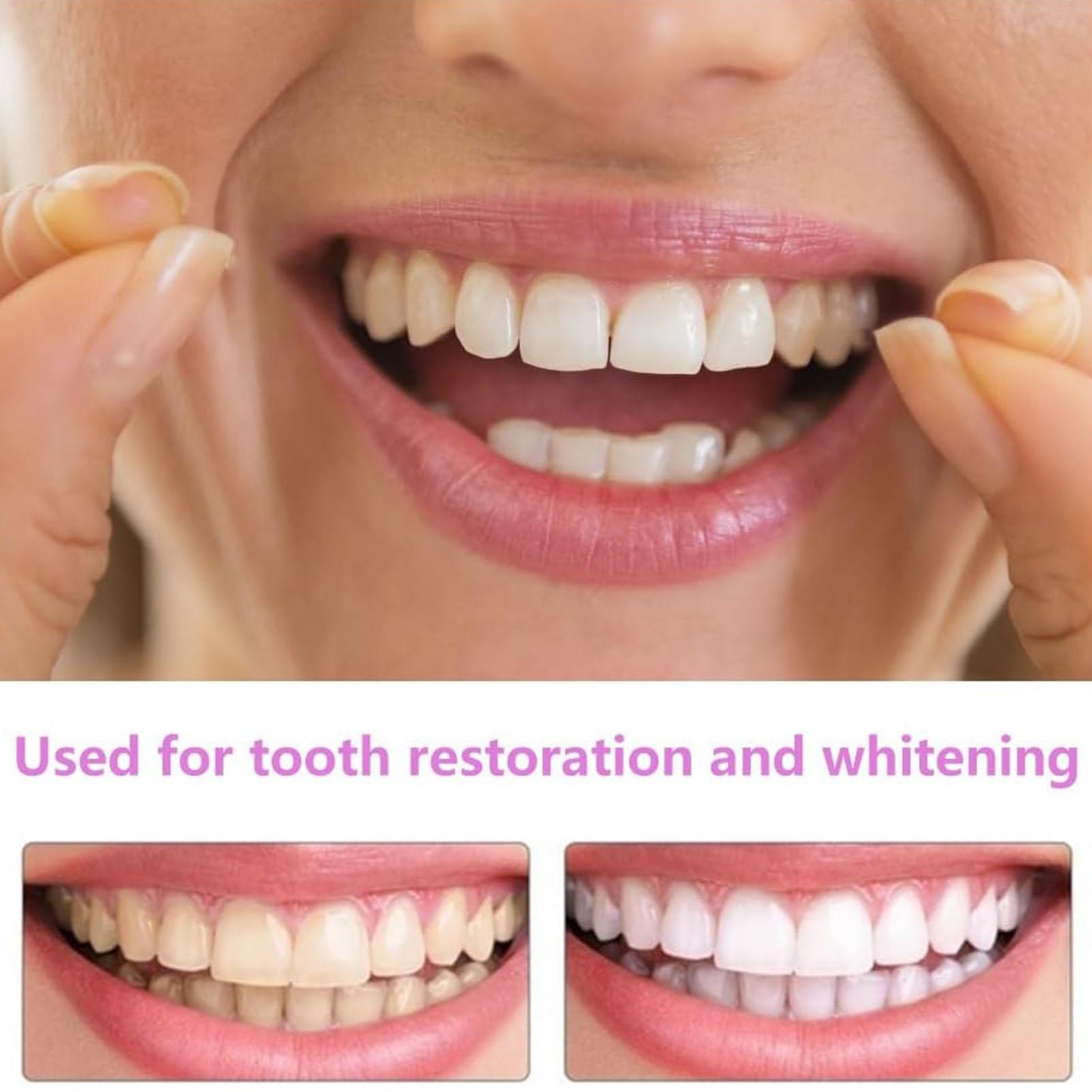 1쌍 장기용 치아 미백 가짜 치아 커버 상하 이빨 재사 - Teeth Whitening Fast 리뷰 및 가격