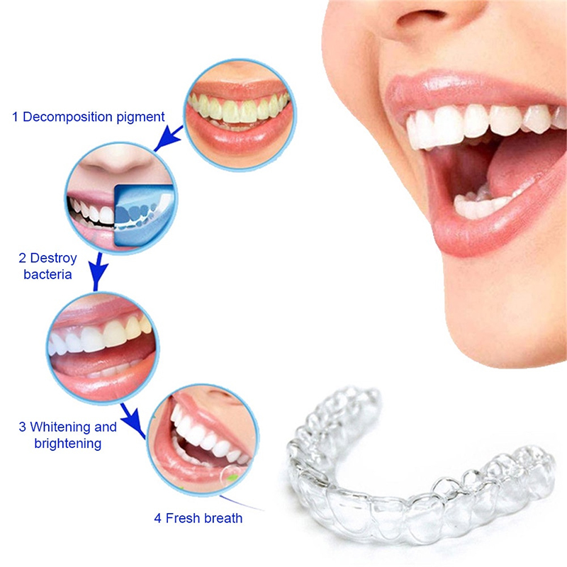 컴포트핏 실리콘 마우스 트레이 야간 치아 보호대 (이갈 - Teeth Whitening With Trays 리뷰 및 가격