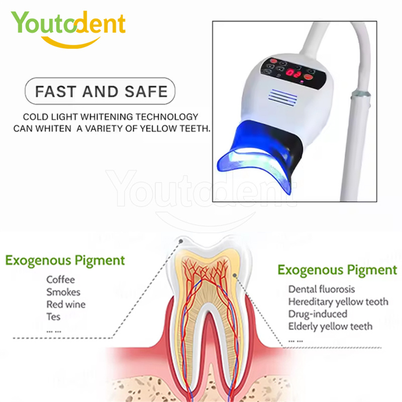 전문 치과용 3색 광 램프 치아 미백기 미백 촉진 장치 - Teeth Whitening Accelerator 리뷰 및 가격