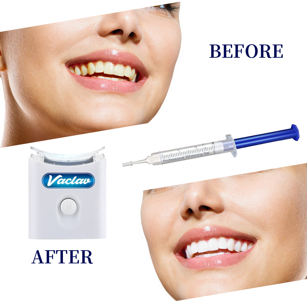민트 치아 미백 젤 주사기 가정용 치아 미백 키트 LE - Teeth Whitening Gel Syringes 리뷰 및 가격