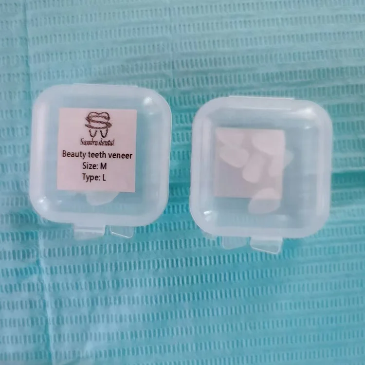 치아 미백 베니어 초강력 레진 치아 베니어 빠른 배송 - Teeth Whitening Fast 리뷰 및 가격