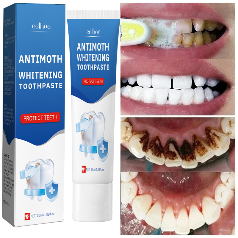 빠른 연기 얼룩 제거 치약 플라크 얼룩 제거 구강 위생 - Teeth Whitening Fast 리뷰 및 가격