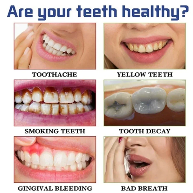 빠른 연기 얼룩 제거 치약 플라크 얼룩 제거 구강 위생 - Teeth Whitening Fast 리뷰 및 가격