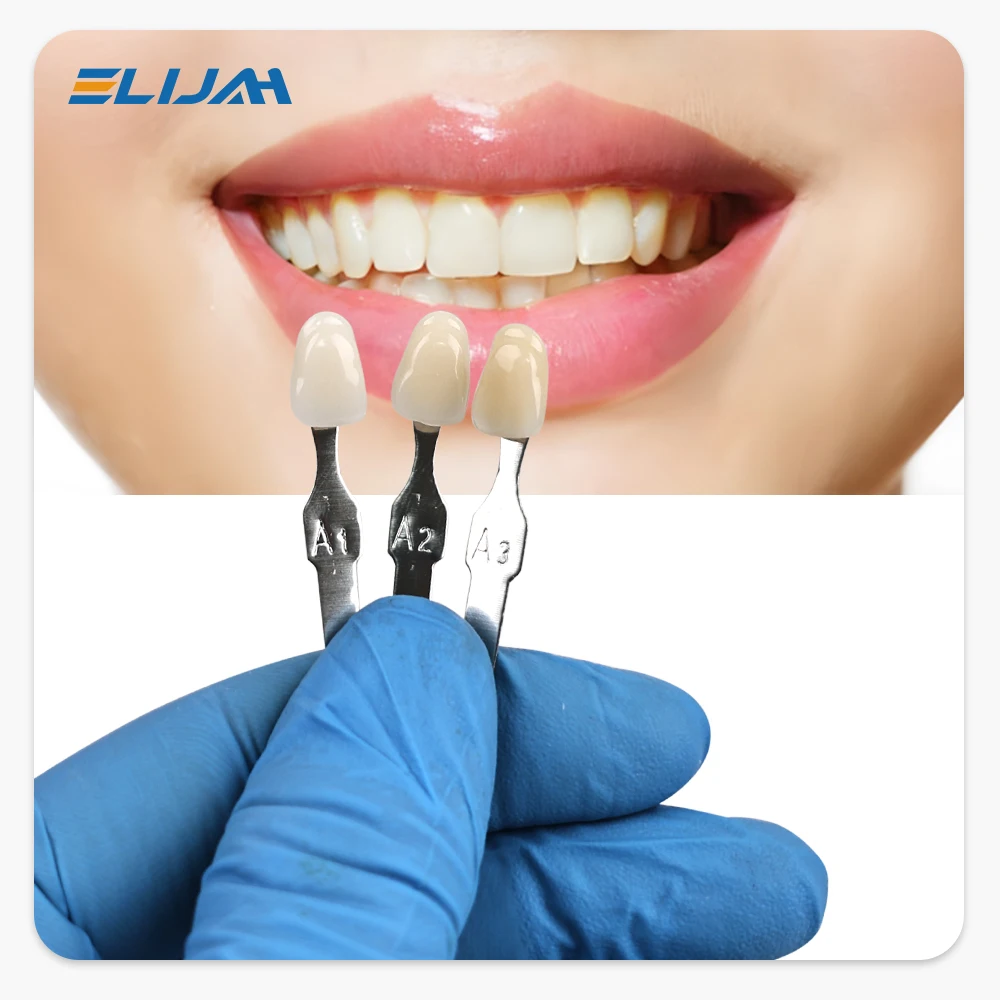 엘리야 마스터 치아 미백 색상표 16색 치아 미백 비교 - Teeth Whitening With Trays 리뷰 및 가격
