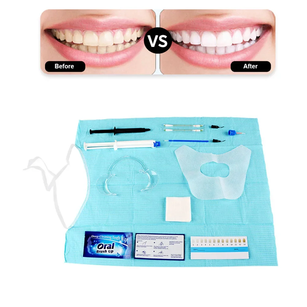 치과의사 클리닉 치아 미백 키트, 35% HP 이중 배 - Teeth Whitening Gel Syringes 리뷰 및 가격