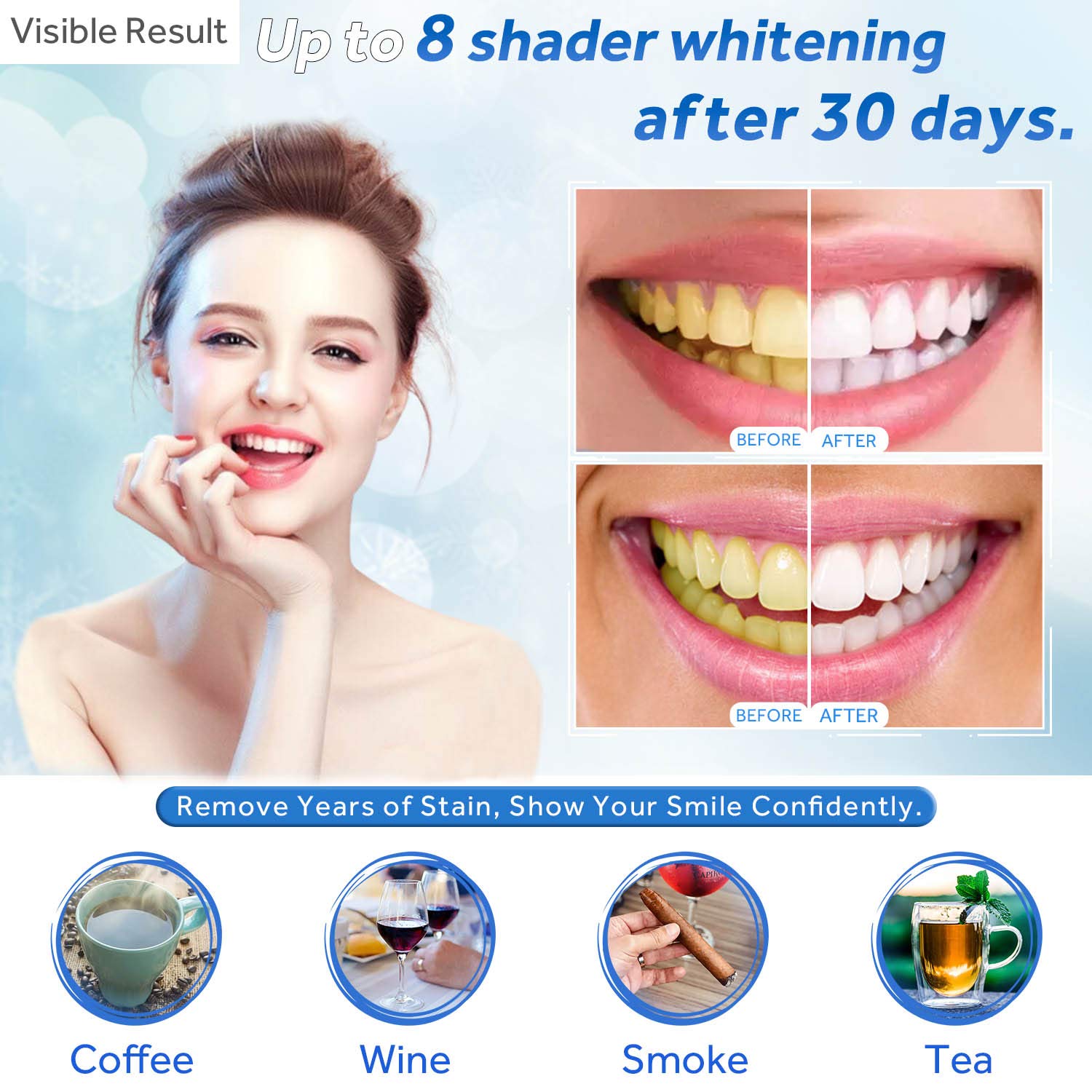 치아 미백 젤 리필 주사기 치아 미백 젤 인비스알라인  - Teeth Whitening With Trays 리뷰 및 가격