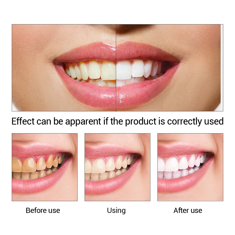 FTEENPLY 치아 미백 에센스 파우더 구강 위생 청 - Teeth Whitening Tips 리뷰 및 가격