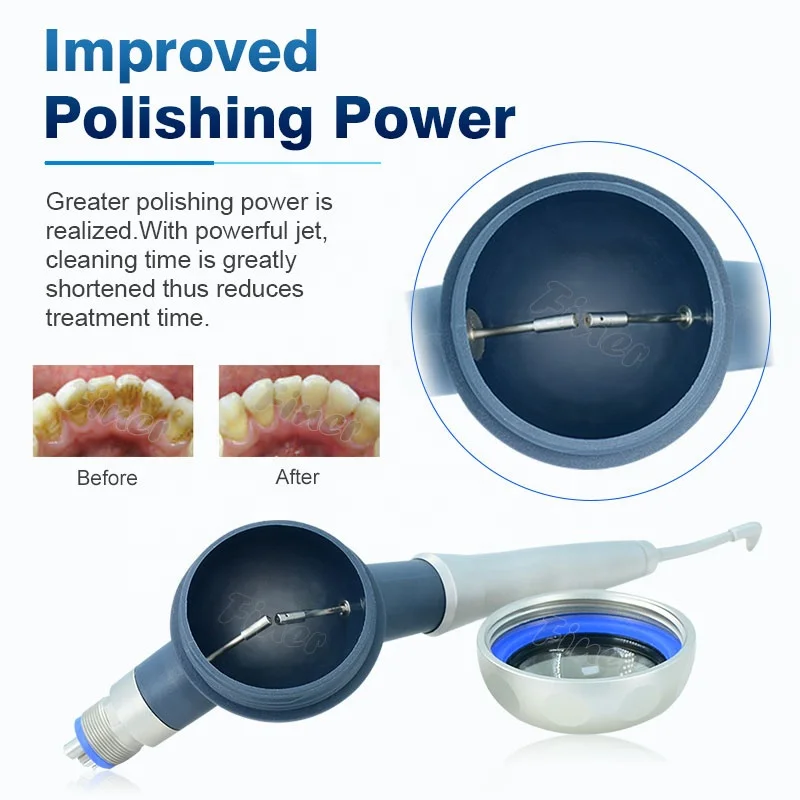 프로피 메이트 치아 세정 미백 에어폴리싱 테라피 공기압 - Teeth Whitening Fast 리뷰 및 가격