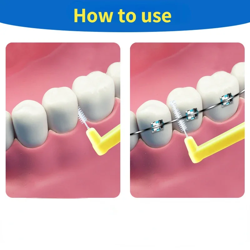 10Pcs L 모양 푸시-풀 치간 칫솔 치열 교정 이쑤 - Teeth Whitening Toothbrush 리뷰 및 가격
