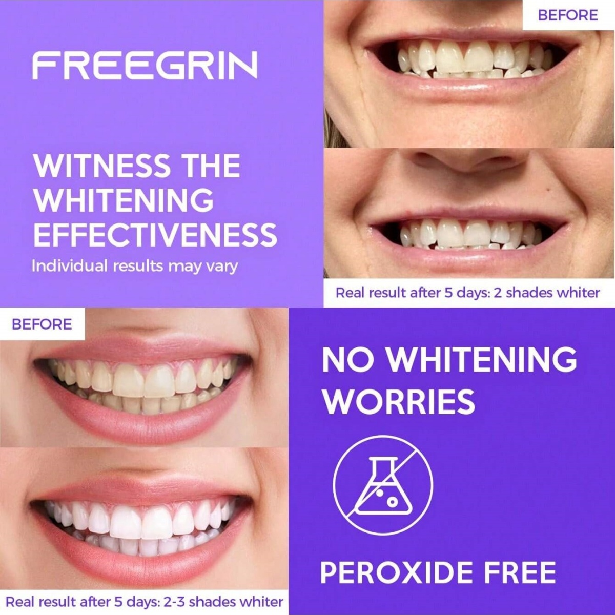 디럭스 화이트닝 치아 스티커 7/14/21 쌍 젤 화이 - Teeth Whitening Doctor 리뷰 및 가격
