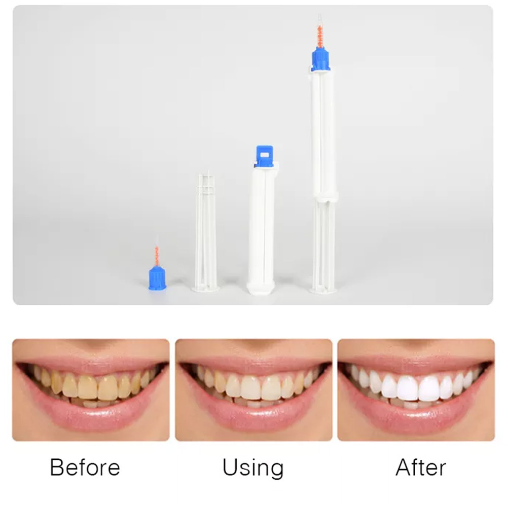 10/5/2개 치과용 듀얼 배럴 주사기 치아 미백 젤  - Teeth Whitening Gel Syringes 리뷰 및 가격