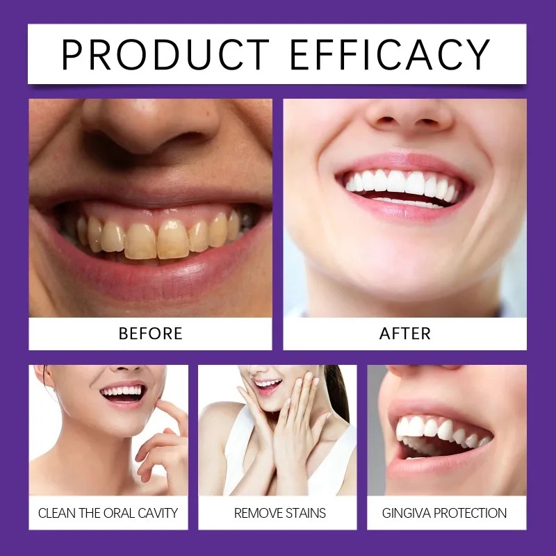 퍼플 치아 복원 미네랄 파우더 브라이트닝 화이트닝 에나 - Teeth Whitening Tips 리뷰 및 가격