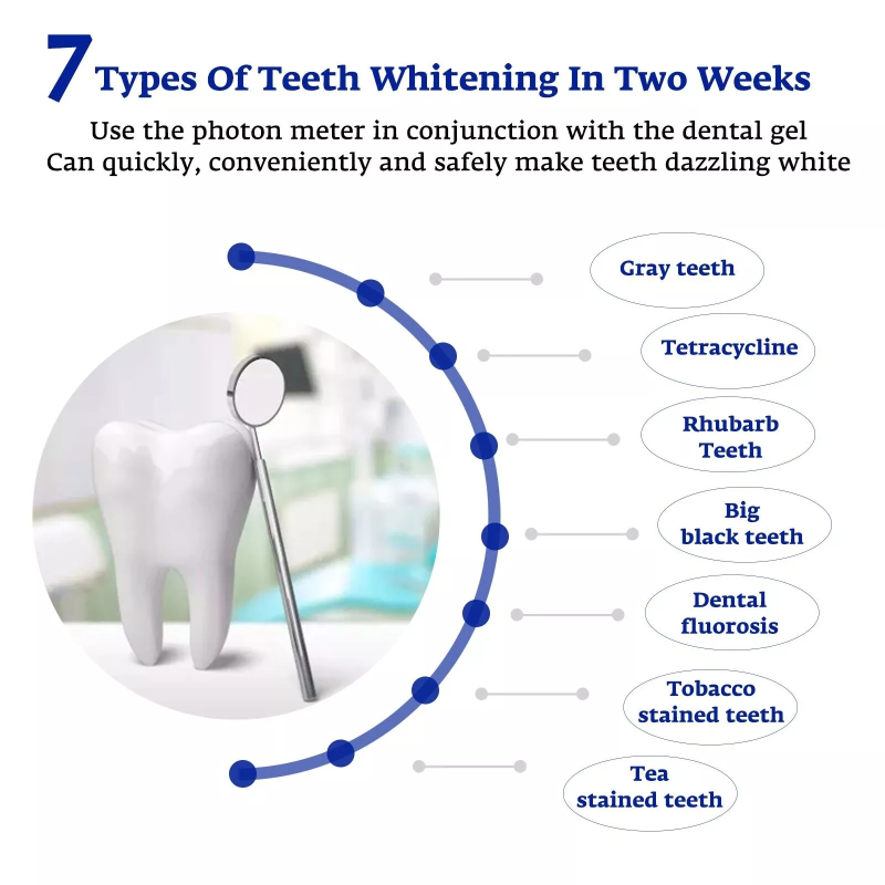 치아 미백 가속기 스마트 LED 블루 라이트 휴대용 U - Teeth Whitening With Trays 리뷰 및 가격