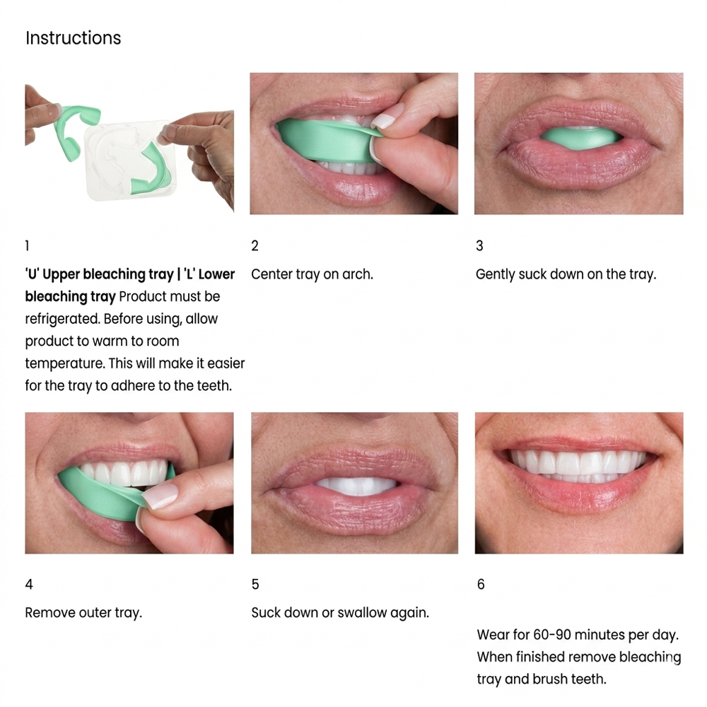오팔레센스 GO 6% 과산화수소 프리필드 치아 미백 트 - Teeth Whitening Opalescence Go 리뷰 및 가격